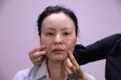 -北京叶子整形美容医院