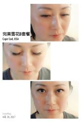 睫毛嫁接-光SPA科技美肤