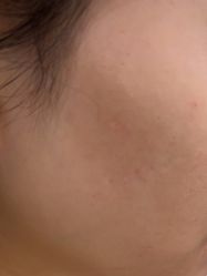 -美瑞莎创美医疗美容