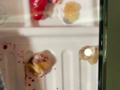 -上海仁爱医院口腔科 · 种植