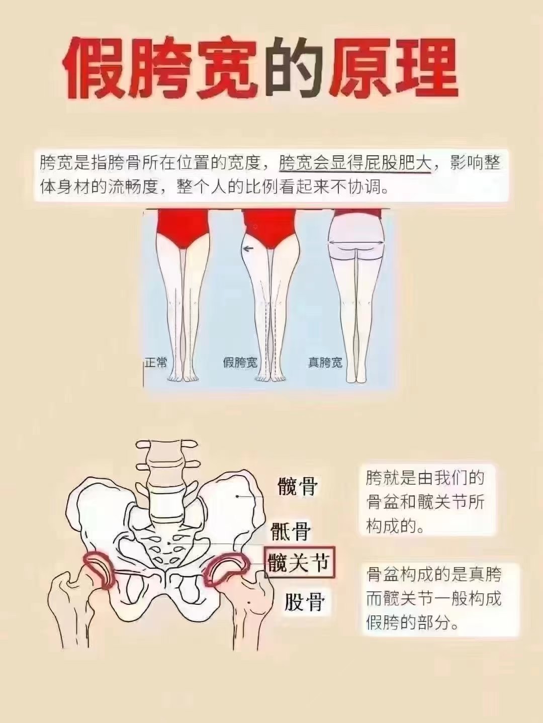 产后大转子骨外凸图片