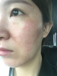 -兰汇祛痘瘦身连锁机构