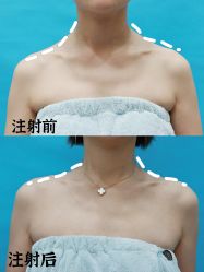 -上海漾颜医疗美容