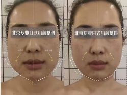 -菊子小颜·日式整骨·产后管理