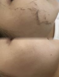 -中科妍美专业脱毛美肤连锁机构