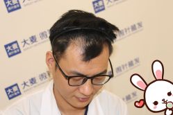 点击看大图 -大麦微针植发丨全国连锁