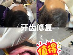 -上海仁爱医院口腔科 · 种植
