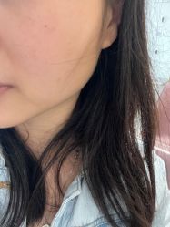 -广州美莱医疗美容医院