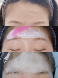体验前-联合丽格·张菡丽格医疗美容
