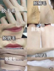 -植蔻妍倍儿专业脱毛·皮肤管理