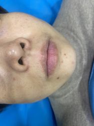 点击看大图 体验前-重庆联合丽格第五医疗美容医院