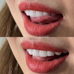 -尊尚柏丽美容SPA