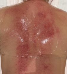 -芳朵美容养生SPA