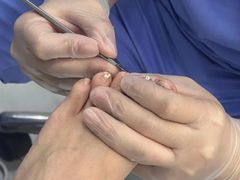 -Andrew指甲专科灰指甲·甲沟炎矫正·3D步态矫形鞋垫定制(浦三路店)