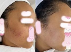 -康美贞·痘肌养护管理中心