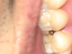 -微笑牙科口腔(三亚迎宾院区)