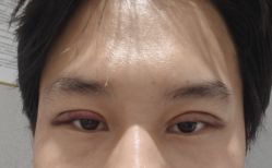 -西安壹加壹医疗美容·西北抗衰旗舰店