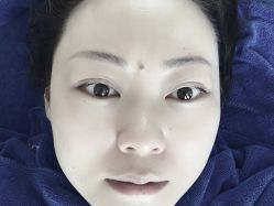 -痘院士专业祛痘皮肤管理