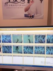 -丝客富脱发养发头皮馆