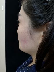 点击看大图 -广州美莱医疗美容医院