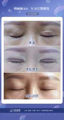 -丰联丽格医疗美容·联合丽格眼整形中心