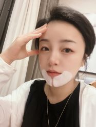 体验后-万州华美紫馨整形美容医院