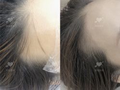 -西施无菌半永久纹绣眉眼影唇轻增发纹发际线