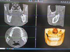 -北京大学口腔医院(第三门诊部)