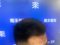 -雍禾植发全国连锁