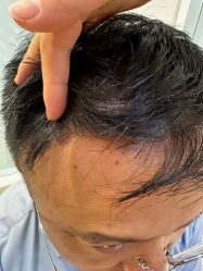 -雍禾植发全国连锁