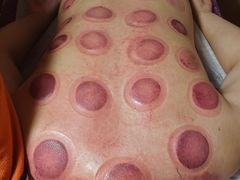 -沈师傅盲人按摩工作室(密三小区店)