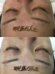-郡艺医疗美容·微整·眼鼻吸脂