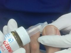 -Andrew指甲专科灰指甲·甲沟炎矫正·3D步态矫形鞋垫定制(上海法华镇路旗舰店)