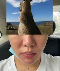 -素美医疗美容·西南眼鼻整形·修复基地