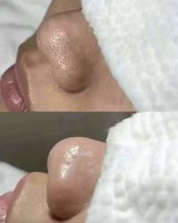 -蕾特恩专业祛痘·皮肤管理