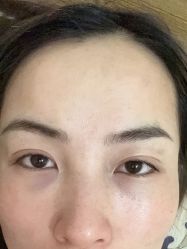 -泉州欧菲医疗美容