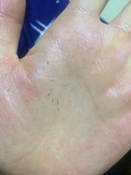 -咪咪比基尼脱毛专业店