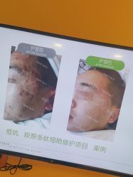 -塑青春&伊肤泉祛痘皮肤管理