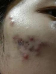 -初颜品佑肌肤管理