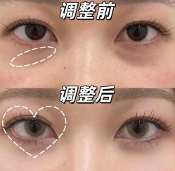 -上海伊莱美医疗美容医院