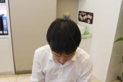-大麦微针植发丨全国连锁