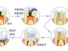 -团圆口腔·种植中心(锦江院区)