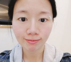 体验前-丽美妍医疗美容·皮秒·立体分层抗衰