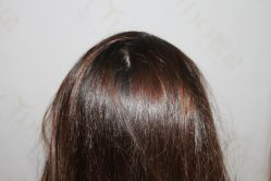 -熙朵美学植发·连锁品牌