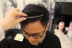 点击看大图 -大麦微针植发丨全国连锁