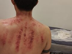 -艾之灸养生馆·推拿·艾灸