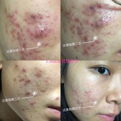 -E.beauty驻颜·痘敏肌调理中心