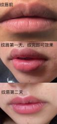 点击看大图 -Verywang半永久纹眉•仪器野生眉