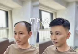 -唐风采假发补发定制