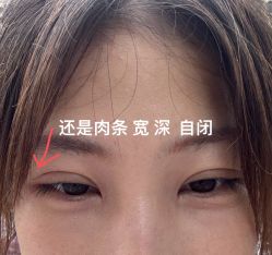 -深圳艺星医疗美容医院